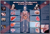 Электрифицированный стенд "Вредные привычки: алкоголизм" - «globural.ru» - Балашиха