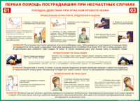 Таблица Порядок действий при опасном кровотечении 1000*1400 винил - «globural.ru» - Балашиха
